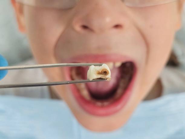 Best Emergency Treatment for Toothache in North Crossett, AR