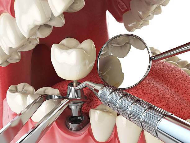 Best Emergency Orthodontic Repairs in North Crossett, AR